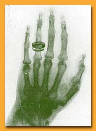early X-ray photograph